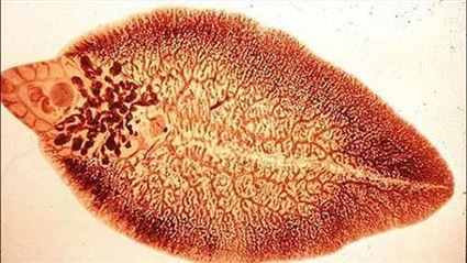 Một số bệnh ký sinh trùng thường gặp, cách nhận biết và phòng tránh