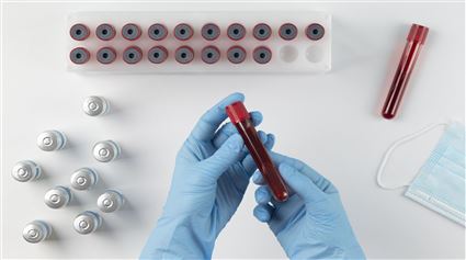 Xét nghiệm đông máu