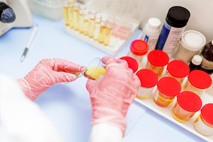 Urinalysis