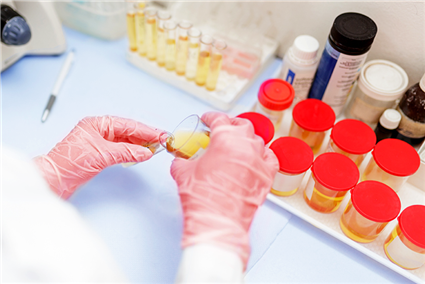 Xét nghiệm nước tiểu